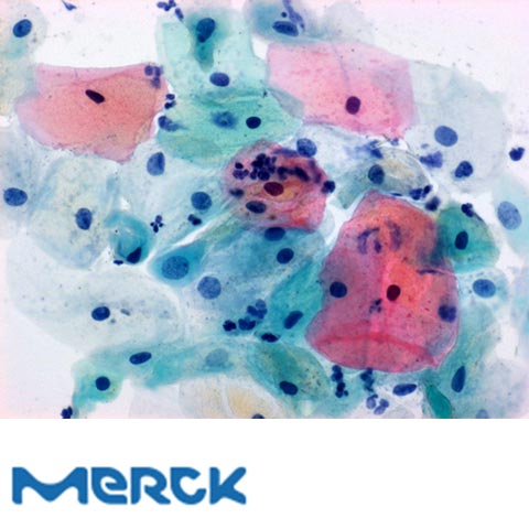 Papanicolaous Solution 2A Orange G Solution (OG 6) For Cytological Cancer And Cycle Diagnosis Merck